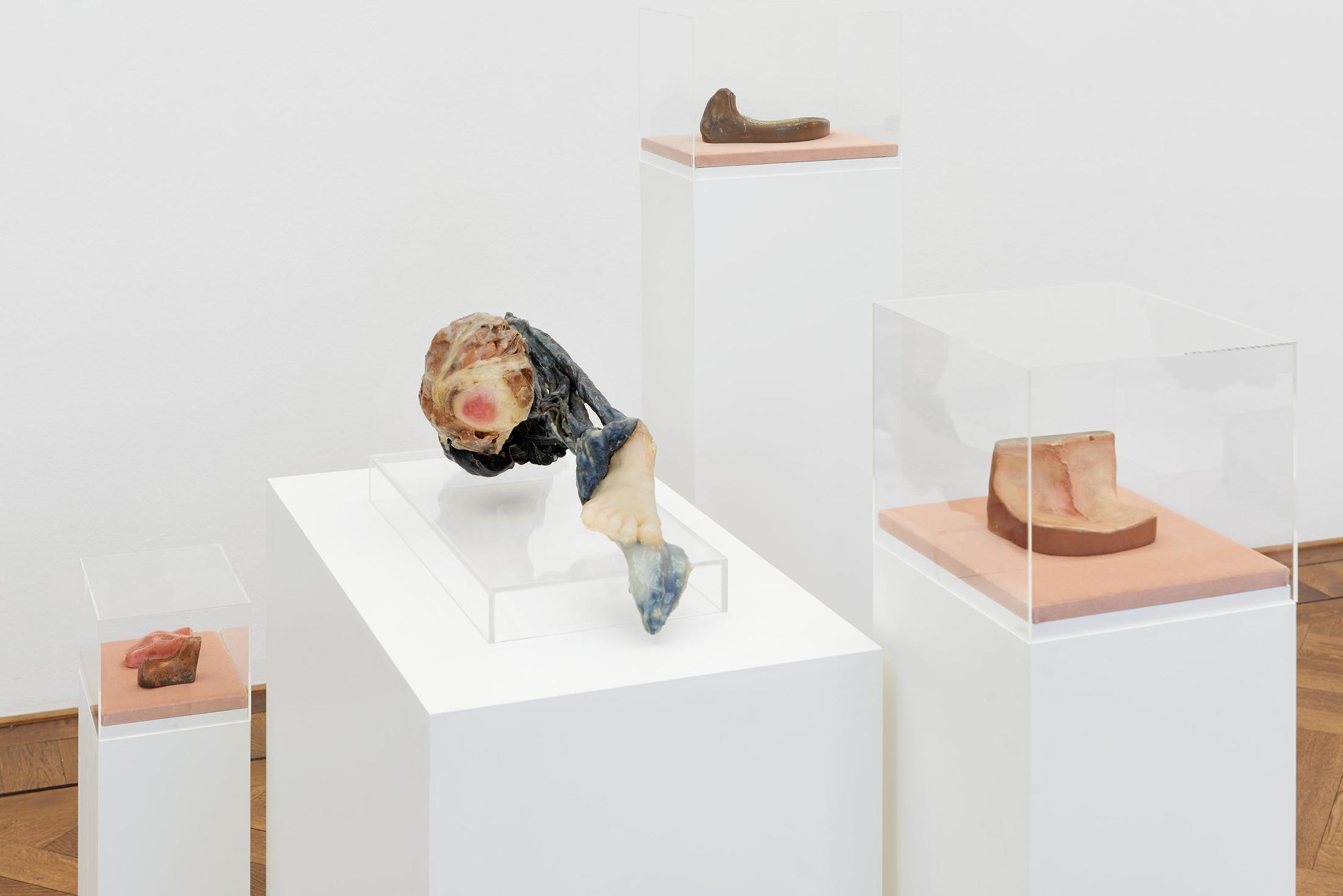 Installation view «Ungestalt», 2017 / © Kunsthalle Basel. Photo: Philipp Hänger/Kunsthalle Basel