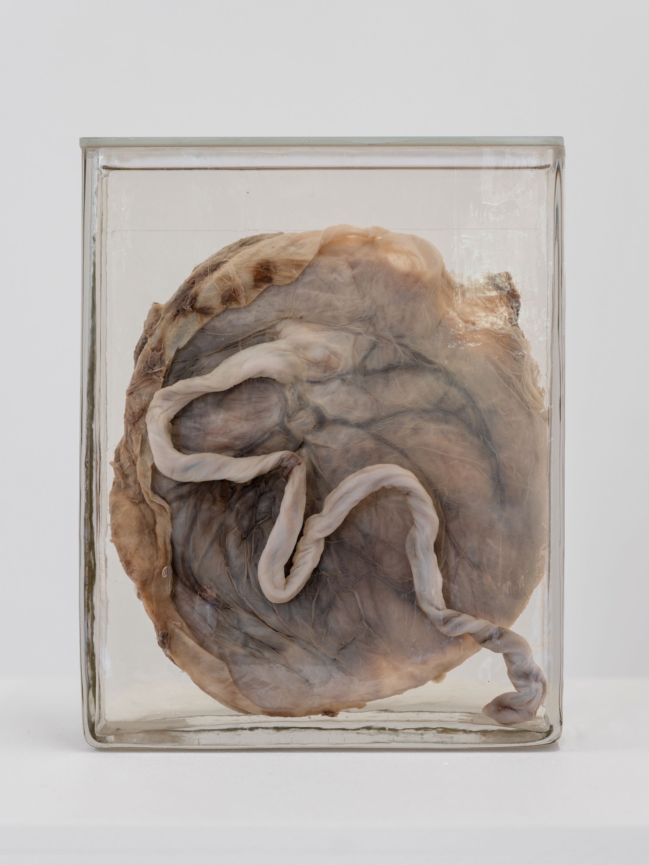 Exhibition View Solo Show Alexandra Bircken «SomaSemaSoma ; view on Origin of the World, 2017, Human placenta, Kaiserling solution, thread, glass» at Kunsthaus Biel, Biel/Bienne, 2025 / Photo: Lea Kunz / Courtesy: Collection Zaza Bircken