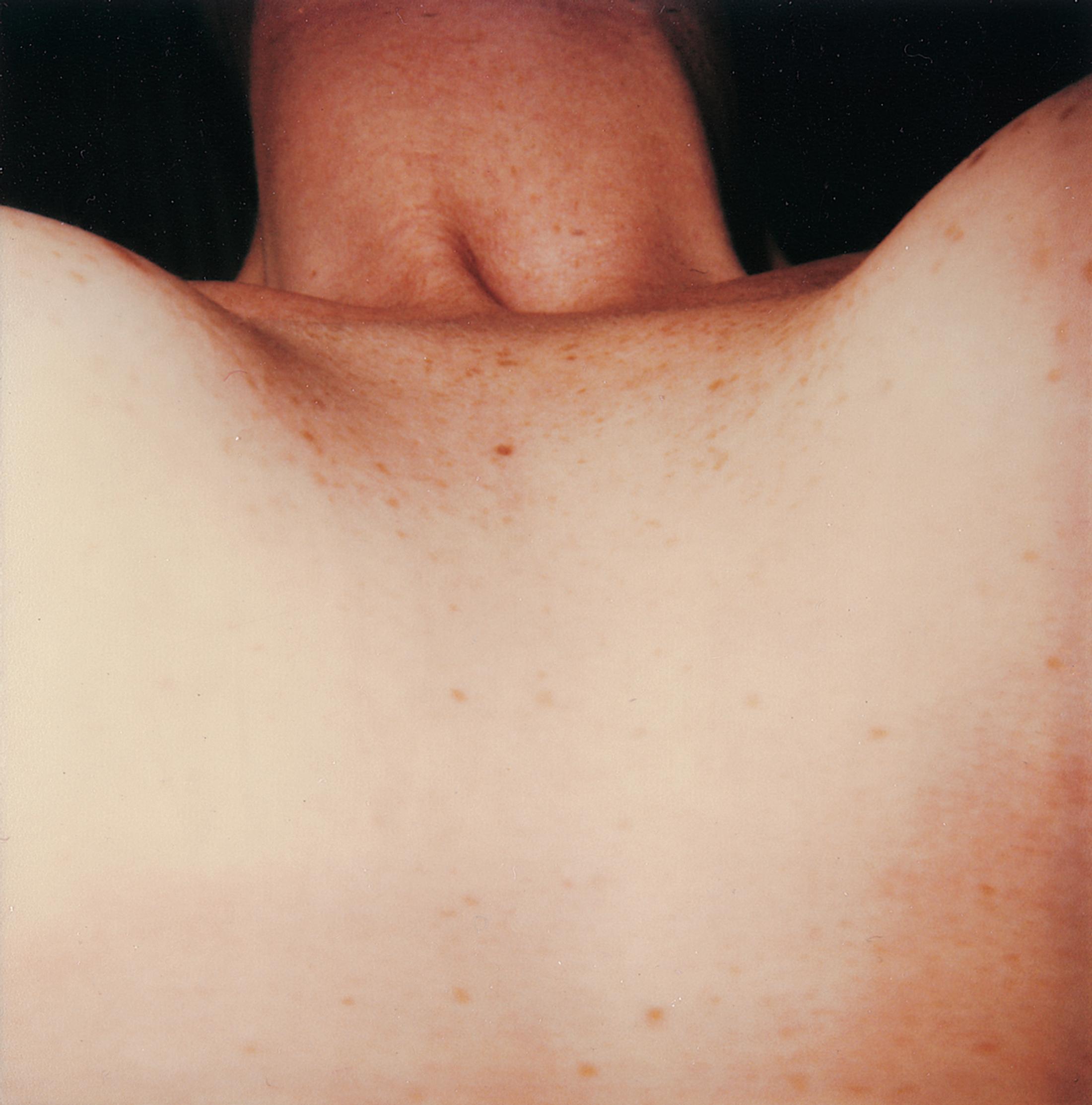 Exhibition View Solo Show «Hannah Villiger» at CIRCUIT, Lausanne, 2023-2024 / Photo: Foundation The estate of Hannah Villiger / Courtesy: Foundation The estate of Hannah Villiger and CIRCUIT, Centre d'art contemporain