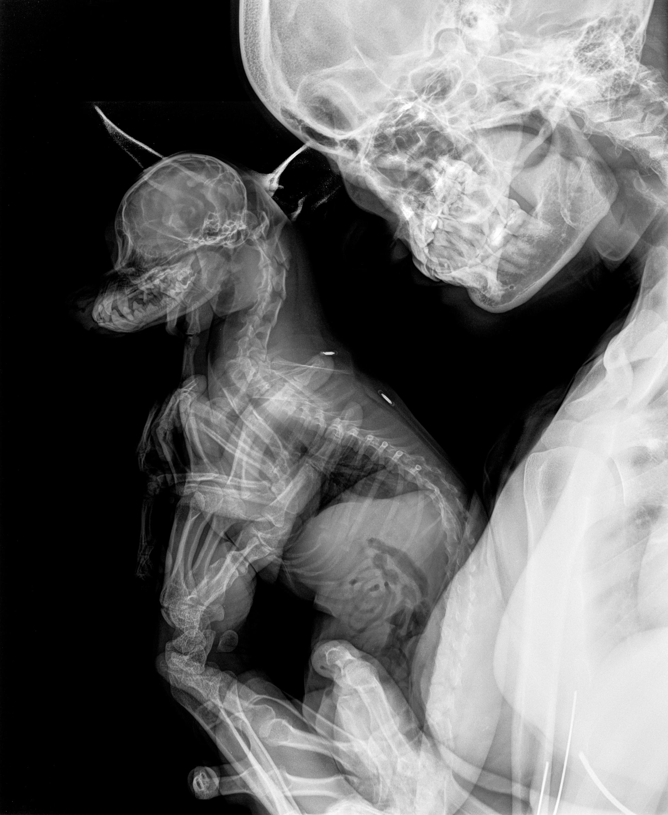 Heji Shin «XRays, 2018» at Kunsthalle Zürich, 2018 / Courtesy: Heji Shin