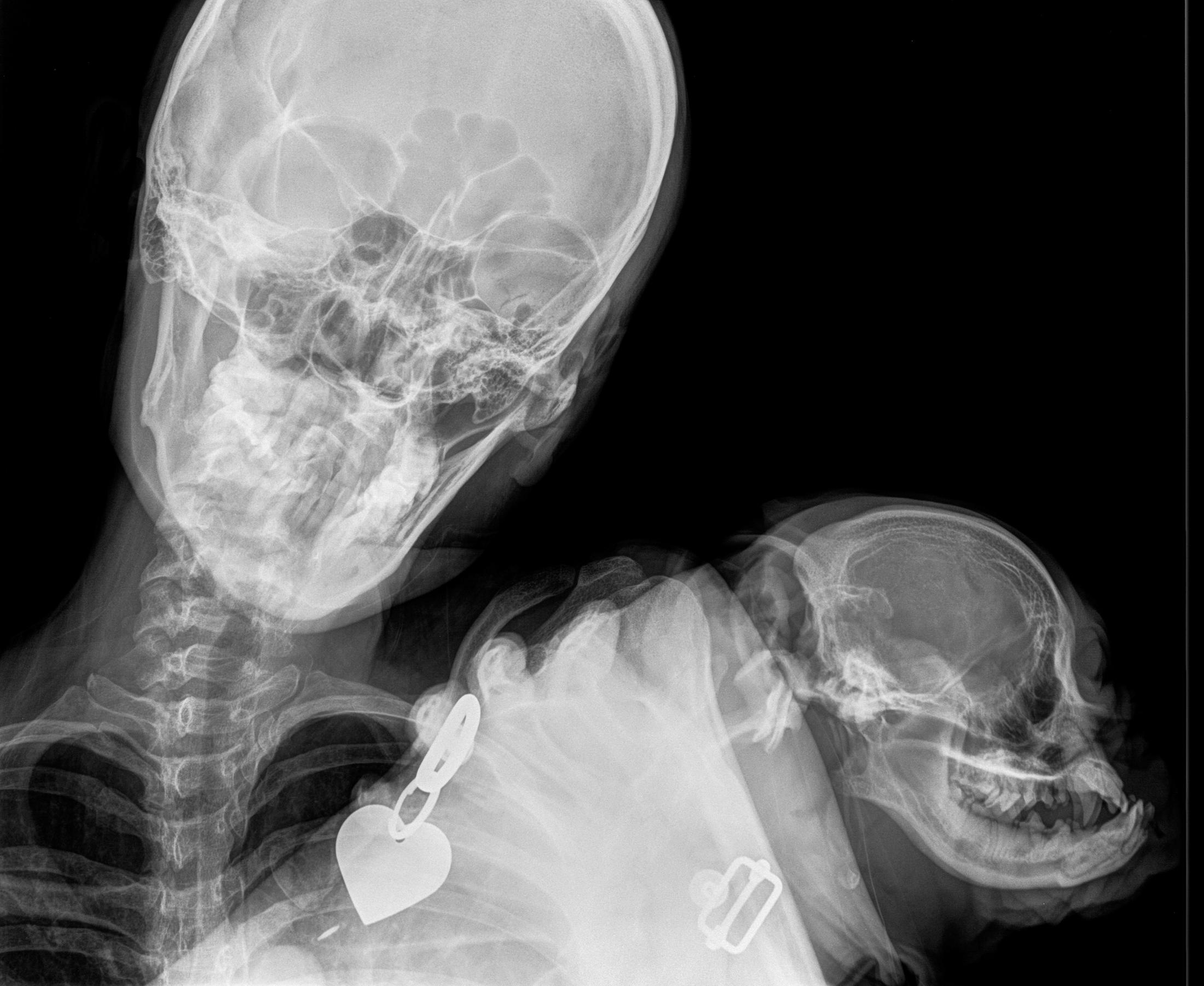 Heji Shin «XRays, 2018» at Kunsthalle Zürich, 2018 / Courtesy: Heji Shin