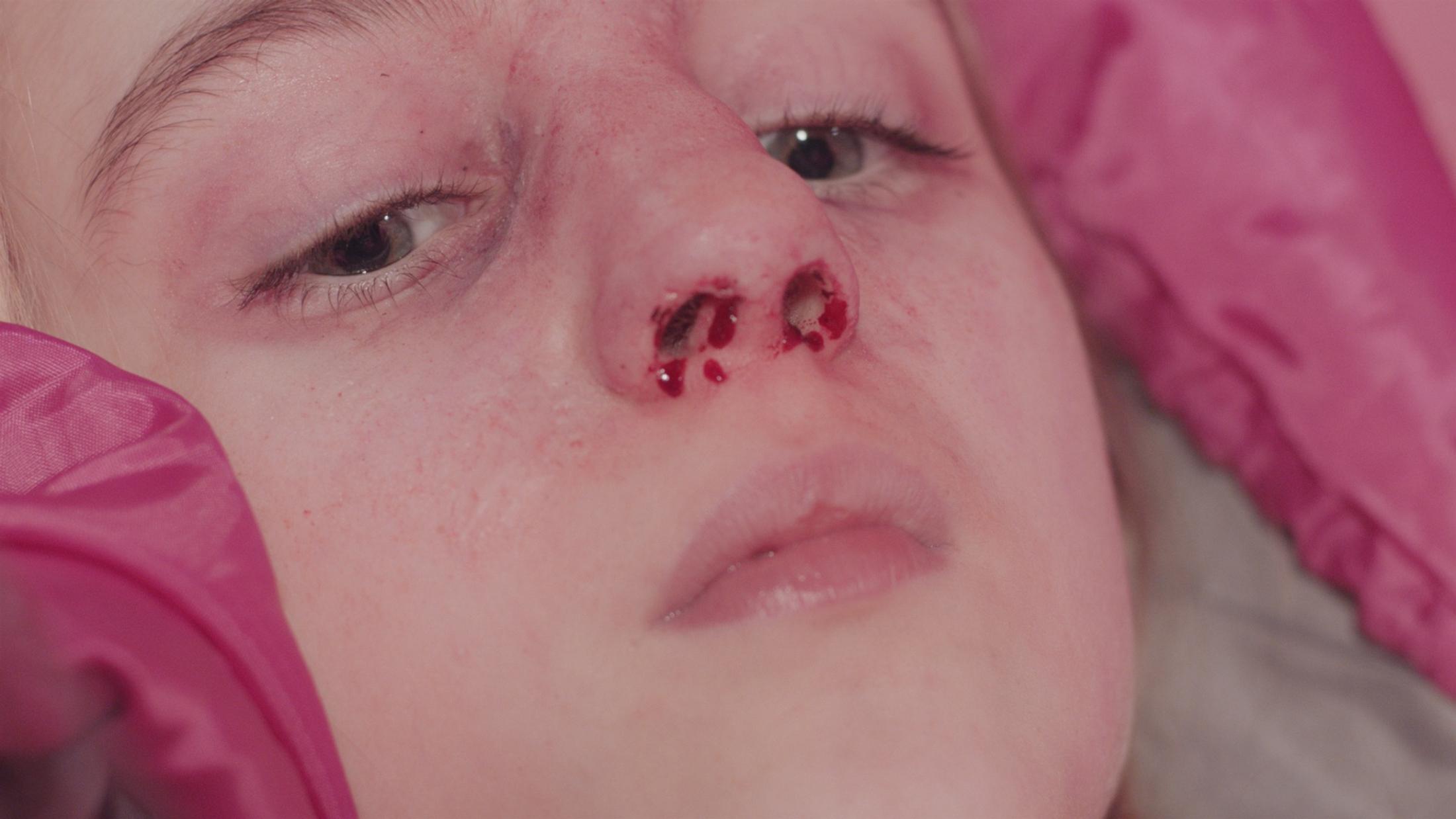 Exbition View Marianna Simnett Soloshow «LAB RATS; view on Blood In My Milk, 2018 (video still)» at Kunsthalle Zürich, Zurich, 2019 / © Marianna Simnett / Courtesy: the artist and Kunsthalle Zürich