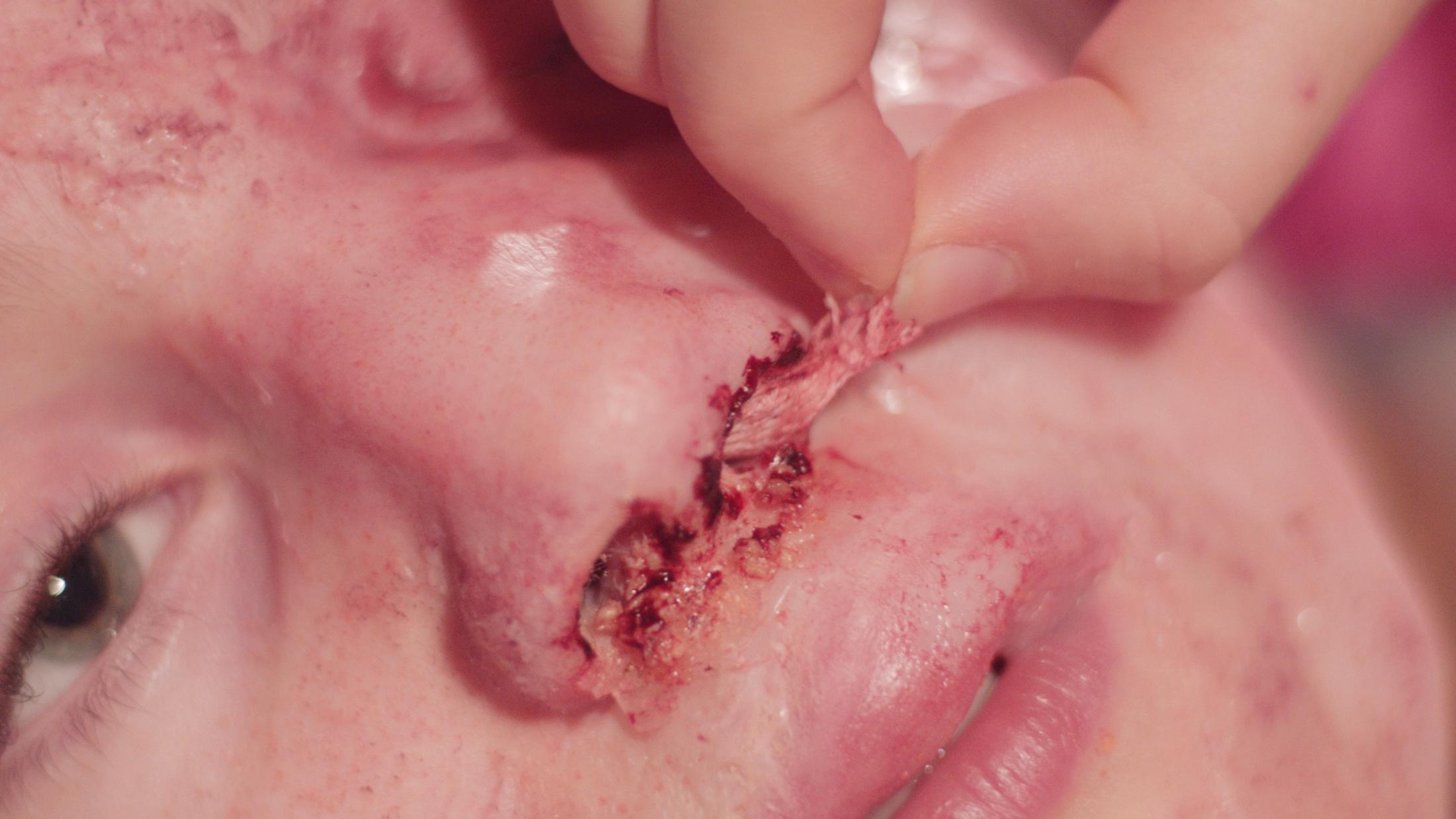 Exbition View Marianna Simnett Soloshow «LAB RATS; view on Blood In My Milk, 2018 (video still)» at Kunsthalle Zürich, Zurich, 2019 / © Marianna Simnett / Courtesy: the artist and Kunsthalle Zürich