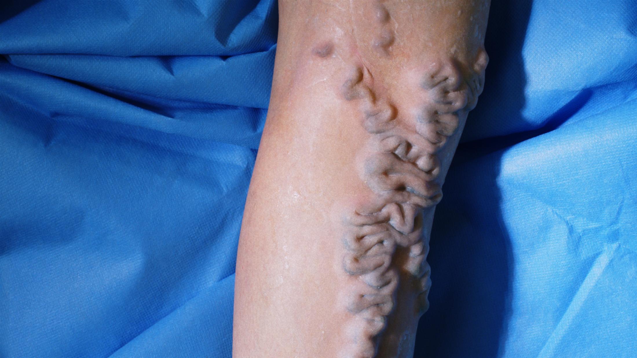 Exbition View Marianna Simnett Soloshow «LAB RATS; view on Blood In My Milk, 2018 (video still)» at Kunsthalle Zürich, Zurich, 2019 / © Marianna Simnett / Courtesy: the artist and Kunsthalle Zürich